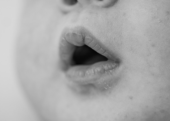 _Z628238